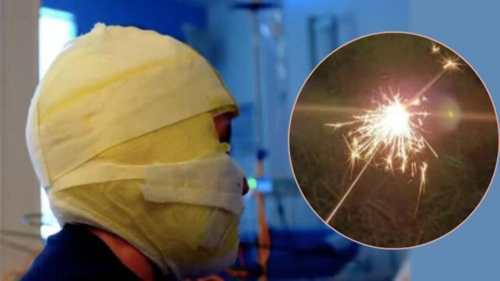 bogota-lesionados-polvora