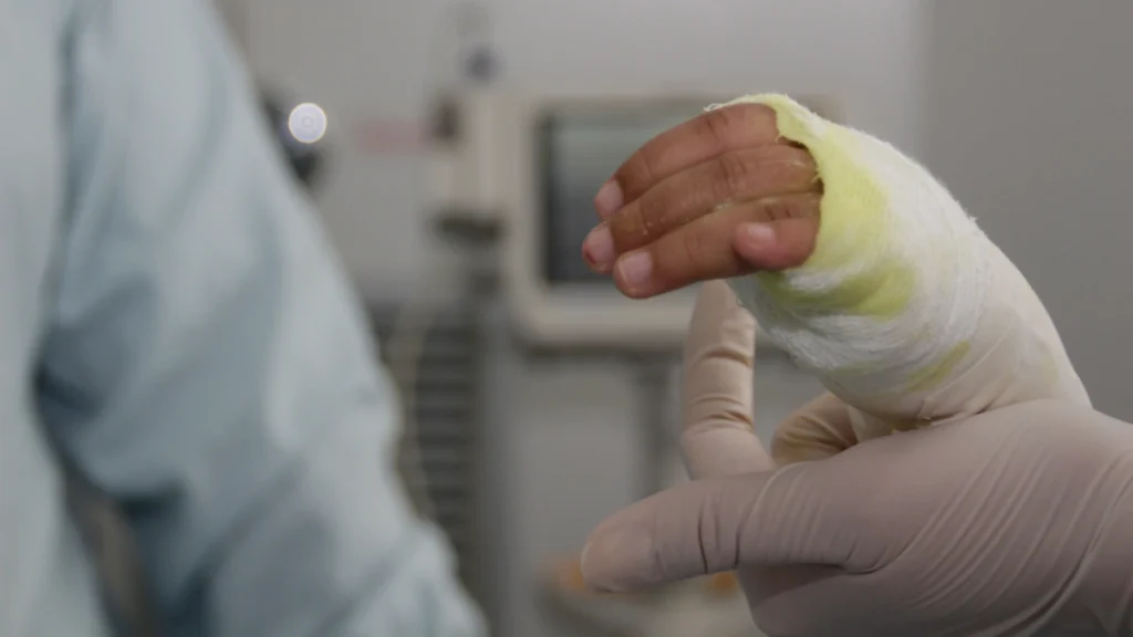 Aumentan las víctimas por pólvora en Cundinamarca: 41 lesionados en lo que va de diciembre